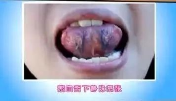 picname